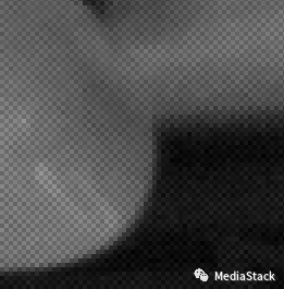 音视频学习--Raw格式引起的图像问题