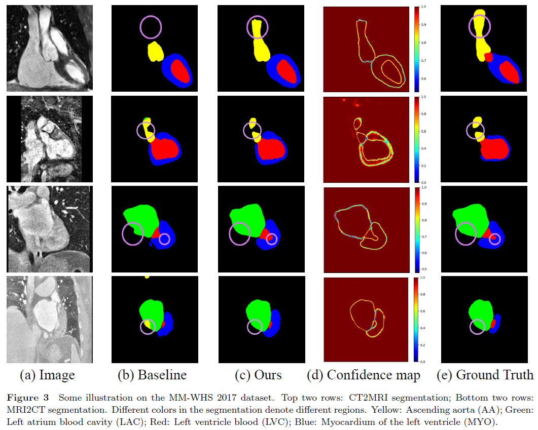 非监督跨模态图像分割中的双网络输出可信度加权互监督学习 | 陈雅婕,杨欣,白翔