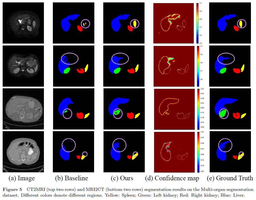 非监督跨模态图像分割中的双网络输出可信度加权互监督学习 | 陈雅婕,杨欣,白翔