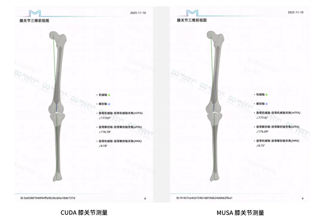 摩尔线程开源MUSA加速版MONAI 1.5.0，国产全功能GPU赋能AI医学影像